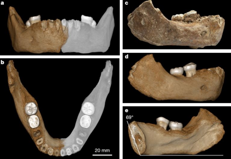 xiahemandible