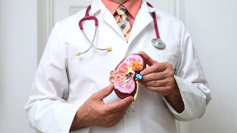 Dr with kidney teaching model